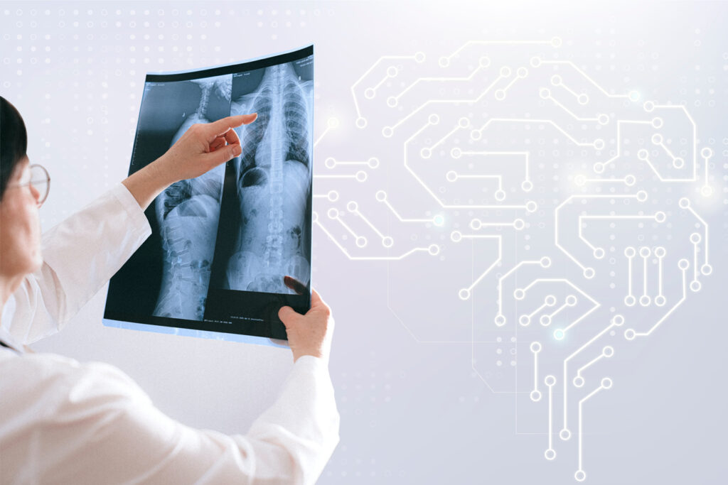 AI Helping Radiologists During Chest X-Ray Review